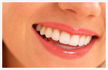 About-Alameda Family Dental Group